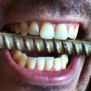 tandenknarsen bruxisme gevaar gebit